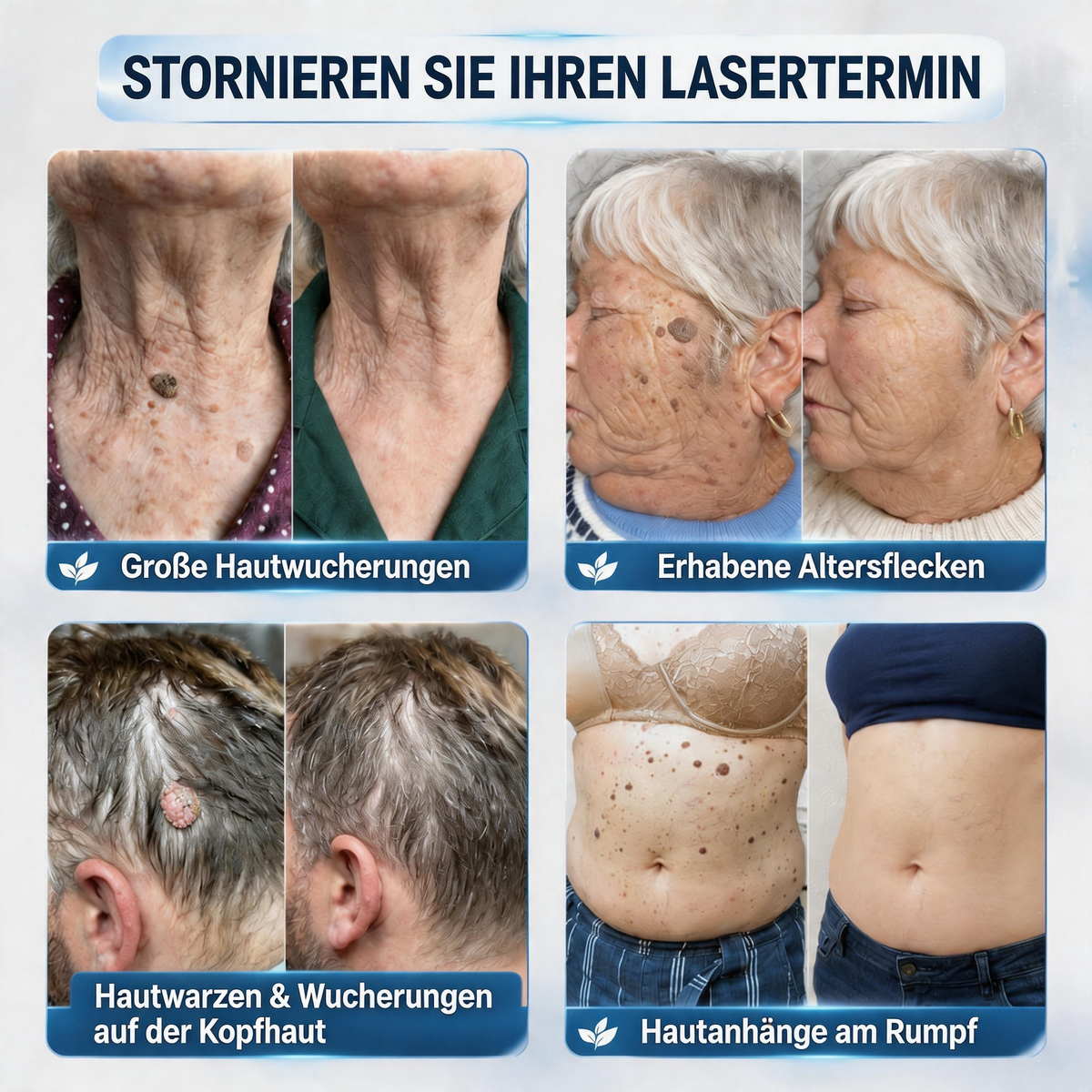 👨‍⚕️Natravor® 𝟕-𝐓𝐚𝐠𝐞 𝐇𝐚𝐮𝐭𝐚𝐧𝐡ä𝐧𝐠𝐬𝐞𝐥- & 𝐅𝐥𝐞𝐜𝐤𝐞𝐧-𝐄𝐧𝐭𝐟𝐞𝐫𝐧𝐮𝐧𝐠𝐬𝐜𝐫𝐞𝐦𝐞 (𝐒𝐜𝐡𝐦𝐞𝐫𝐳𝐟𝐫𝐞𝐢𝐞 𝐅𝐨𝐫𝐦𝐞𝐥 – 𝐨𝐡𝐧𝐞 𝐍𝐚𝐫𝐛𝐞𝐧)